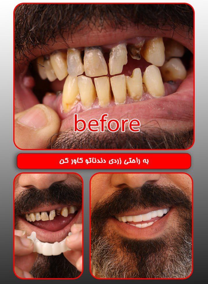 ترو اسمایل اصلی آلمانی رزین به همراه جایزه 200 هزار تومانی ترو اسمایل اصلی آلمانی رزین به همراه جایزه 200 هزار تومانی